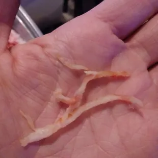 HARD plastic like fibers INSIDE the shrimp rings (sweet n sour shrimp)