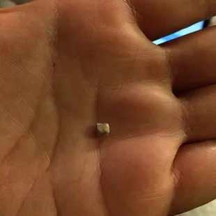 There was a small pebble in my food!!!!!!!!