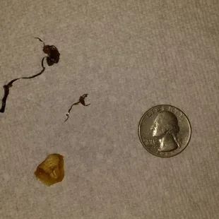 Found what appears to be two stove-cleaning brush bristles and possibly some type of melted Styrofoam? I put a Quarter for size reference.