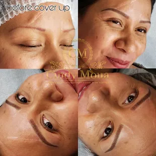 Cover-up is possible with 3D microblading and shading.