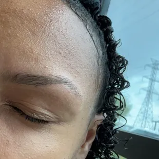 Botched brows.