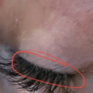 Her lashes with visible glue build up and her complaining of pain!
