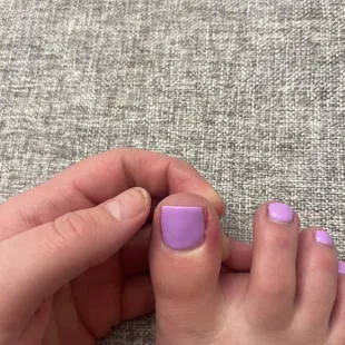 Inflamed right toe