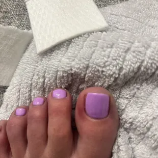 Inflamed toe