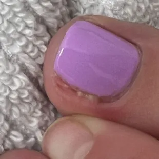 Pus leaking