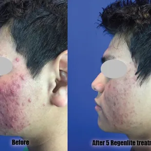 No medications, no pain, no side-effects!