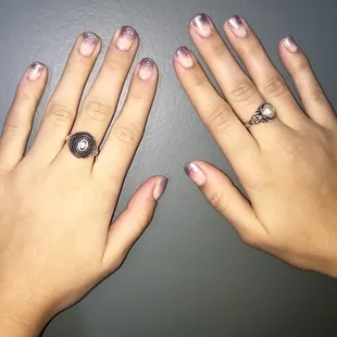 Esthetics-Lincoln-NE