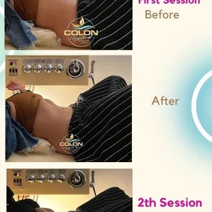 Laying in the colonic table with before and after.