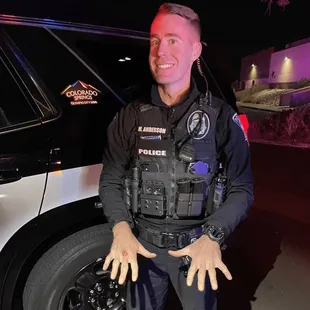 October 9 Punch a Homeless Vet Contestant showing off his victory ouchies.