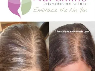 NuFemme Rejuvenation Clinic - Albuquerque