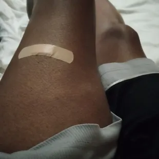 a man with a bandage on his leg