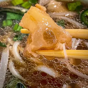 Gotta have the tendon