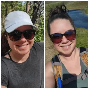 Weight loss success story. Call to find out more. 209-712-3579