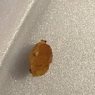 That's hard cold chicken all through my food.