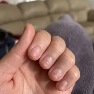 My nails after taking them off. Brittle, dry and deteriorating from the cheap acrylic