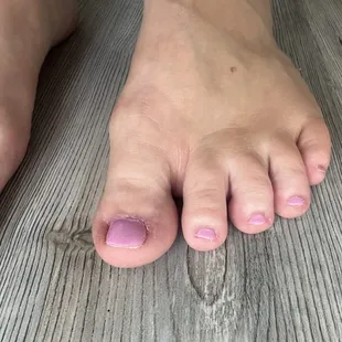 Horrible pedicure. Jagged edges, uneven filing, and sloppy polish.