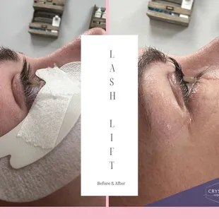 Lash Lift Before &amp; After