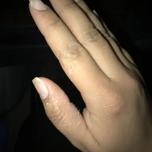 Peeling on my skin