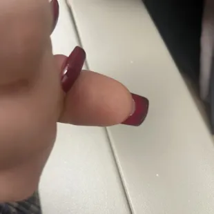 Gel in nail