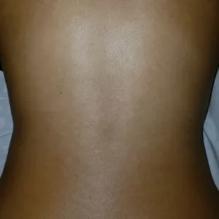 Before&amp;After pictures of my lovely clients back.