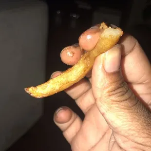 Undercooked Greasy Fries