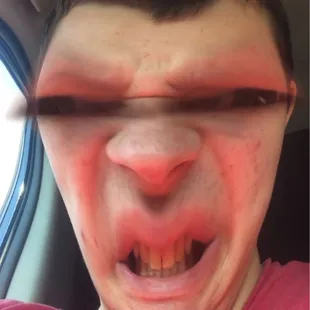 a man&apos;s face with blood on it