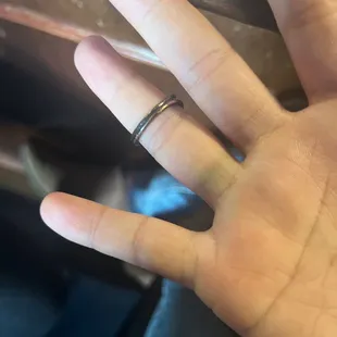 Green finger from a ring