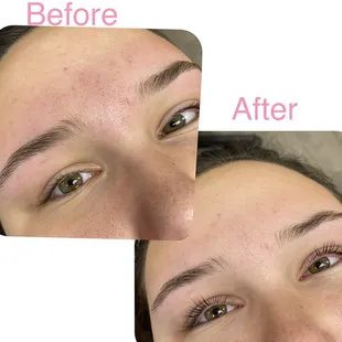 Lash lift