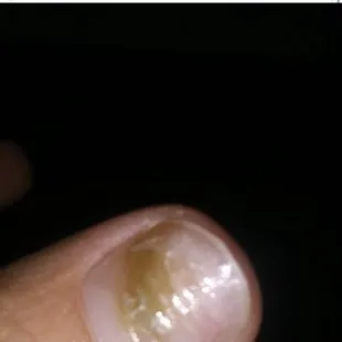 Green junk on bed of nail. From Acrylics.