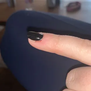 bloody nail from being cut by drill multiple times