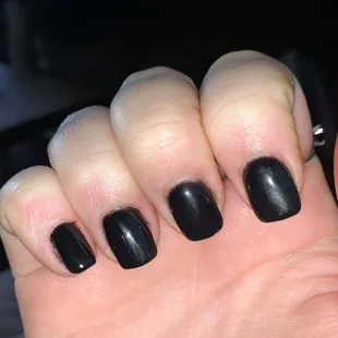 another bloody nail, notice how the nail is so far removed from my nail bed on my middle finger. lots of black dip on my skin