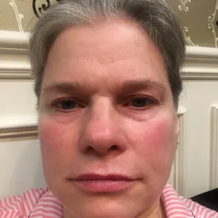 Co2 laser went incredibly well today. Before pictures.