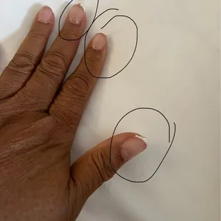 Chipping polish on third day after initial visit.