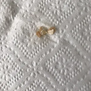 Egg shells in their Pad Thai