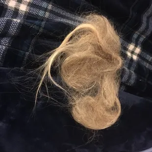 All of my hair was pulled out.