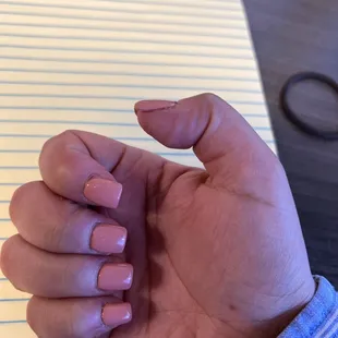 Looks like chiclets super thick and uneven.