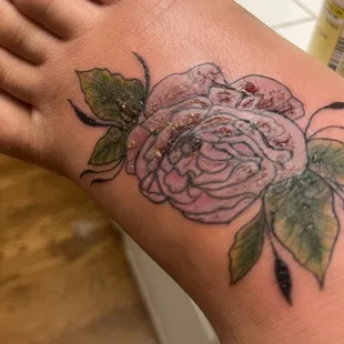 Inflamed and in so much pain.