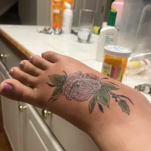 Inflamed and in so much pain.