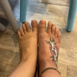 so swollen i could not walk