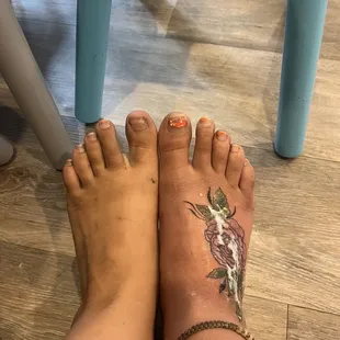 Extremely swollen, I could not walk.