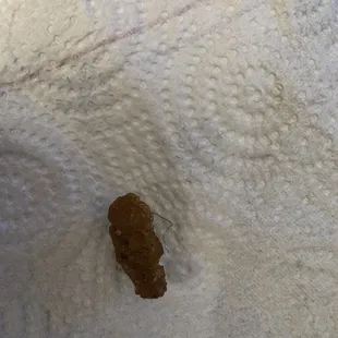 Hair in my food