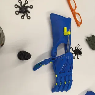 3D printed prosthetics