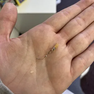 a person's hand with a tiny insect on it