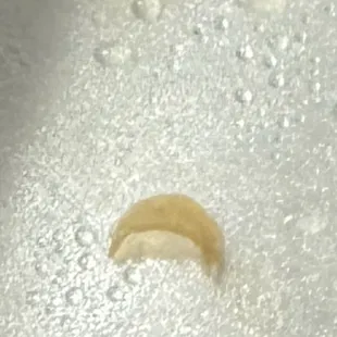 This is the actual piece of finger nail tip that was cooked in the food.