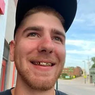 We do custom Gold Grillz