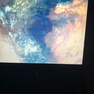 Camera kitchen sink drainline