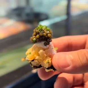 Opening bite of baller set