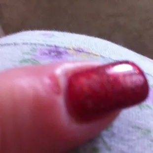 Sandy (she&apos;s pregnant) Knicks me every time but this time she made a blister and also knicked me!!!