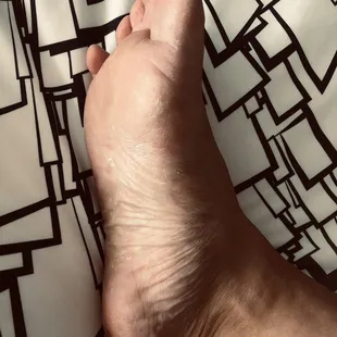 Sorry for the ugly foot!!