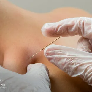 #1 Chiropractor in Lexington, KY, experience the best chiropractic adjustments, dry needling, massage therapy, and treatment ...